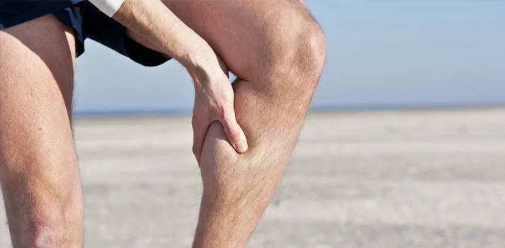 Nặng chân, tê mỏi chân, chuột rút về đêm: Dấu hiệu bệnh giãn tĩnh mạch