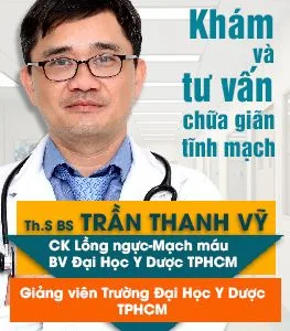 Tư vấn về bệnh giãn tĩnh mạch và phương pháp điều trị hiệu quả