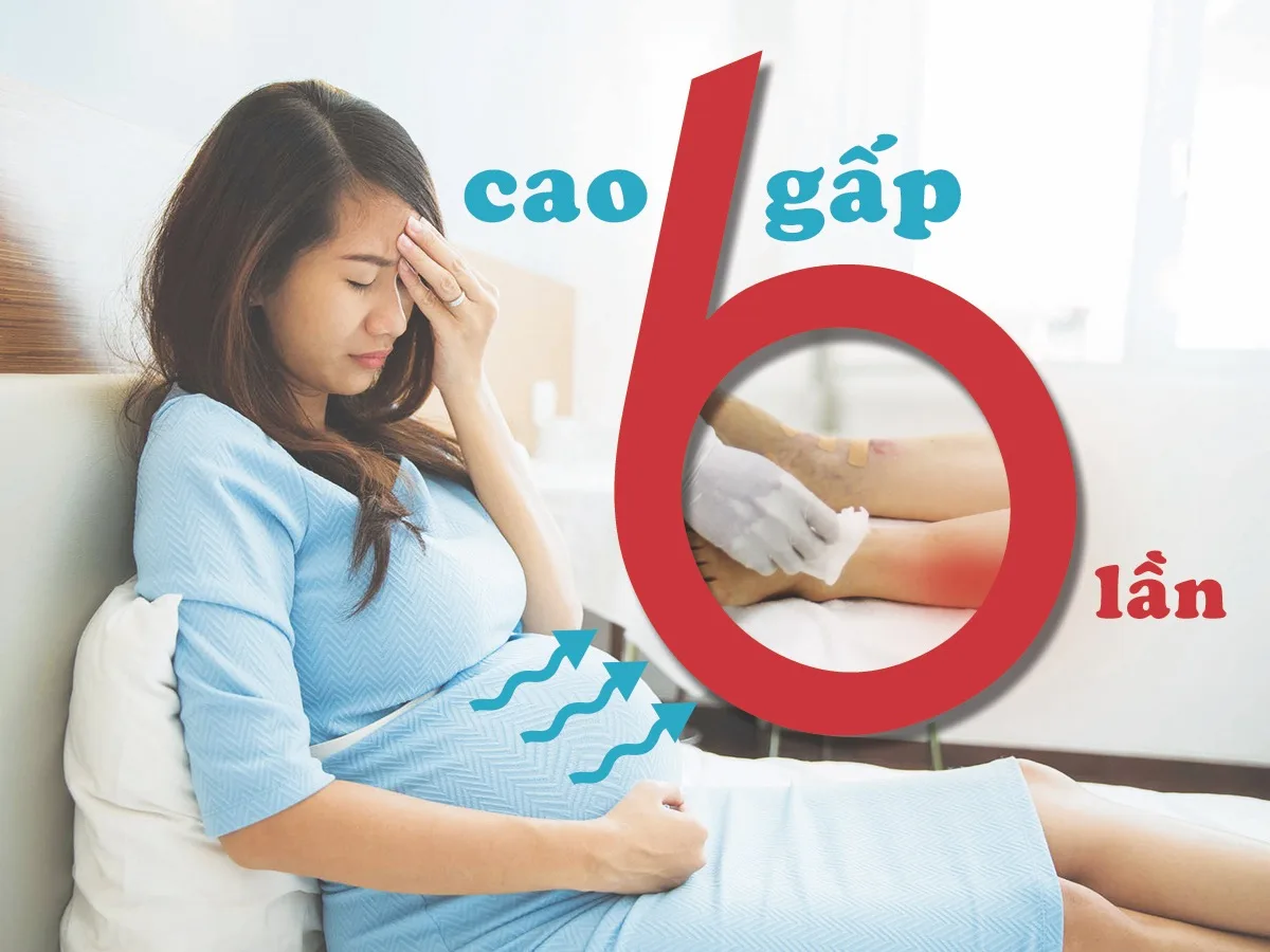 NHỮNG PHỤ NỮ CÓ NGUY CƠ CAO BỊ CỤC MÁU ĐÔNG TRONG LÒNG TĨNH MẠCH
