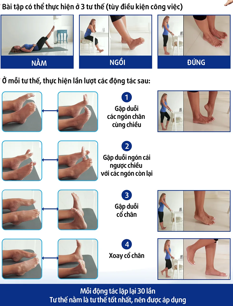 Bài tập giãn tĩnh mạch chân mà bạn nên biết