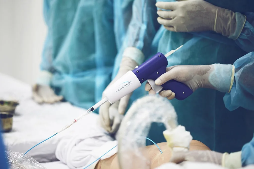 Giải pháp điều trị giãn tĩnh mạch chân hiệu quả