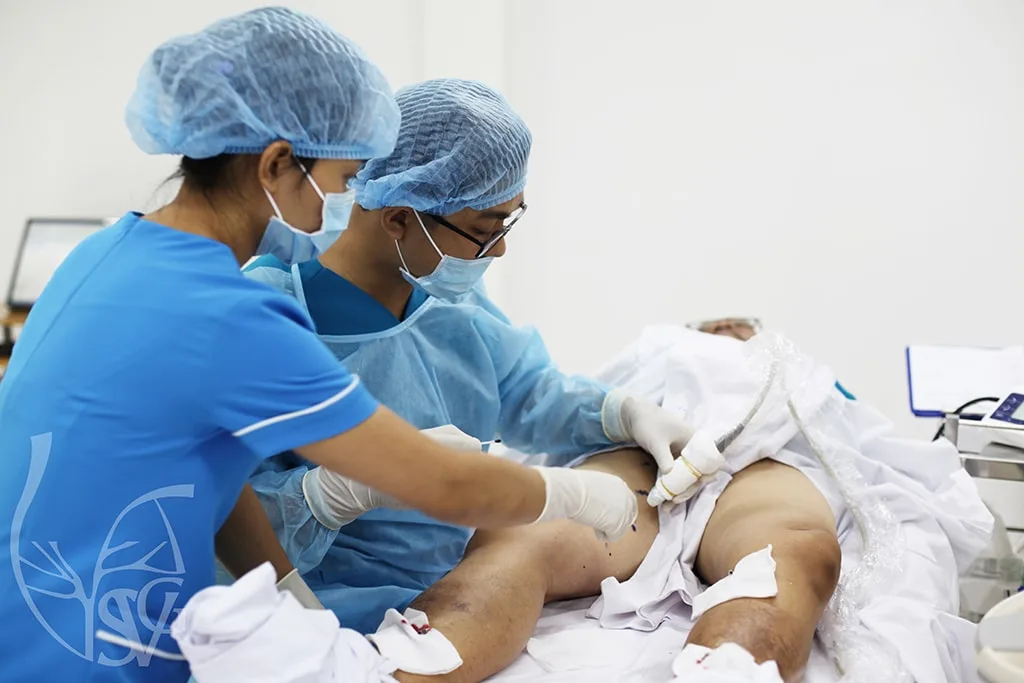 Phương pháp điều trị không phẫu thuật – laser nội mạch