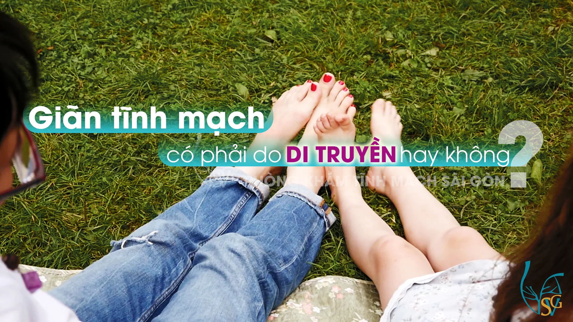 Giãn tĩnh mạch có phải do di truyền hay không?