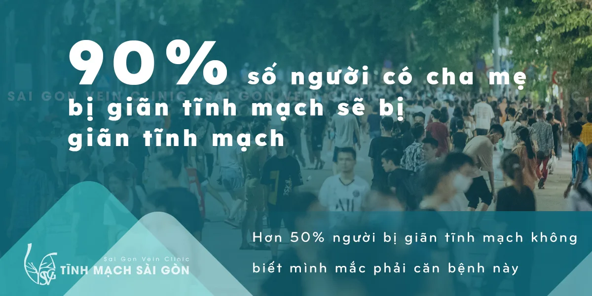 Giãn tĩnh mạch – Cảnh báo từ những con số