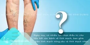 TM - Cau hoi ve Tm 03082021