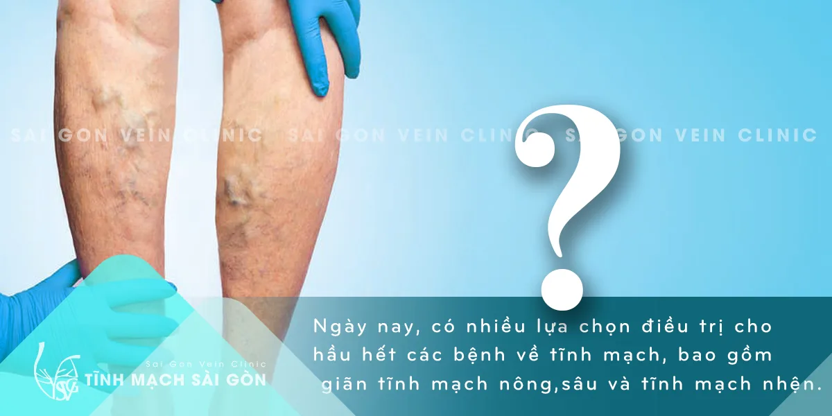 Đặt câu hỏi về việc điều trị giãn tĩnh mạch