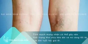 TM TMMang Nhen 11082021