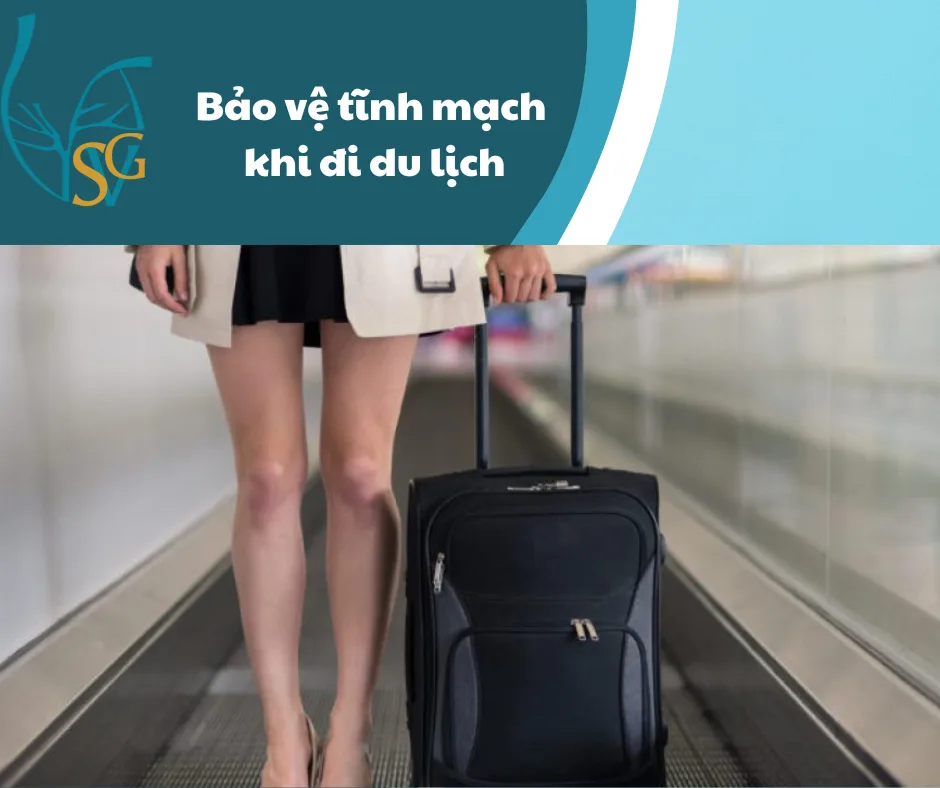 Bảo vệ sức khỏe tĩnh mạch khi đi du lịch trên các phương tiện giao thông