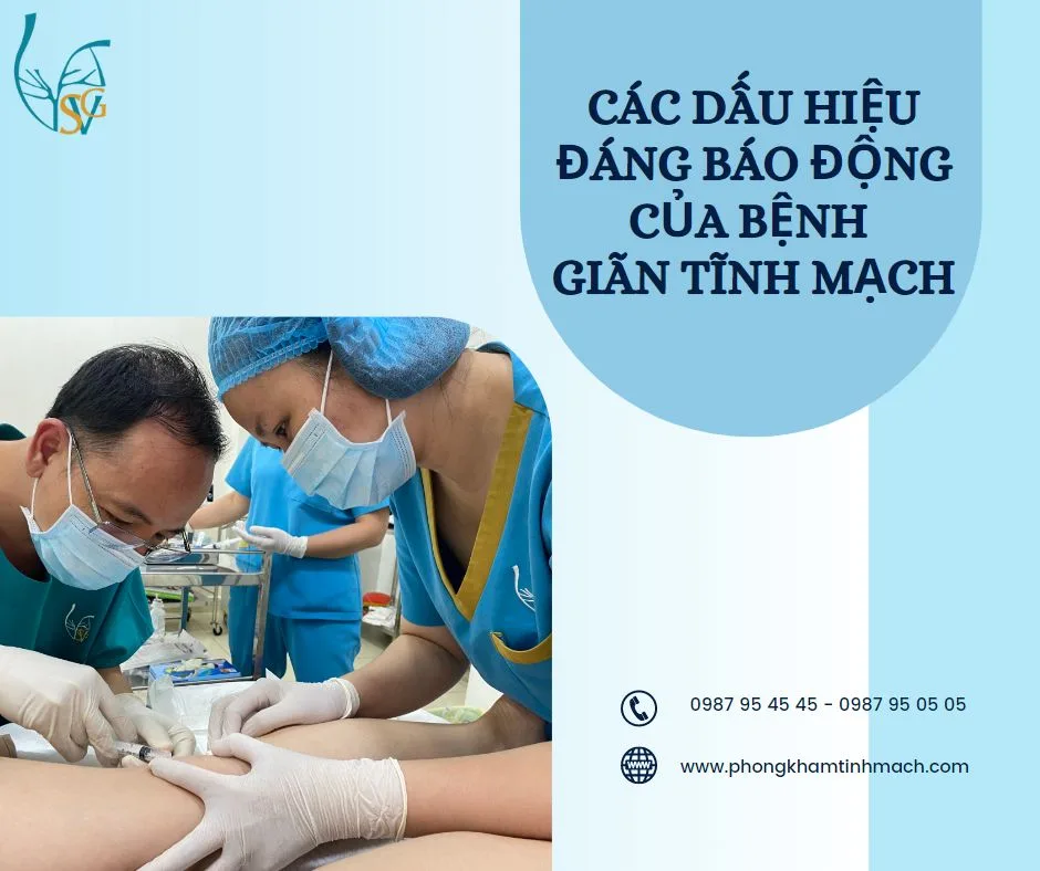 Các dấu hiệu đáng báo động của bệnh giãn tĩnh mạch