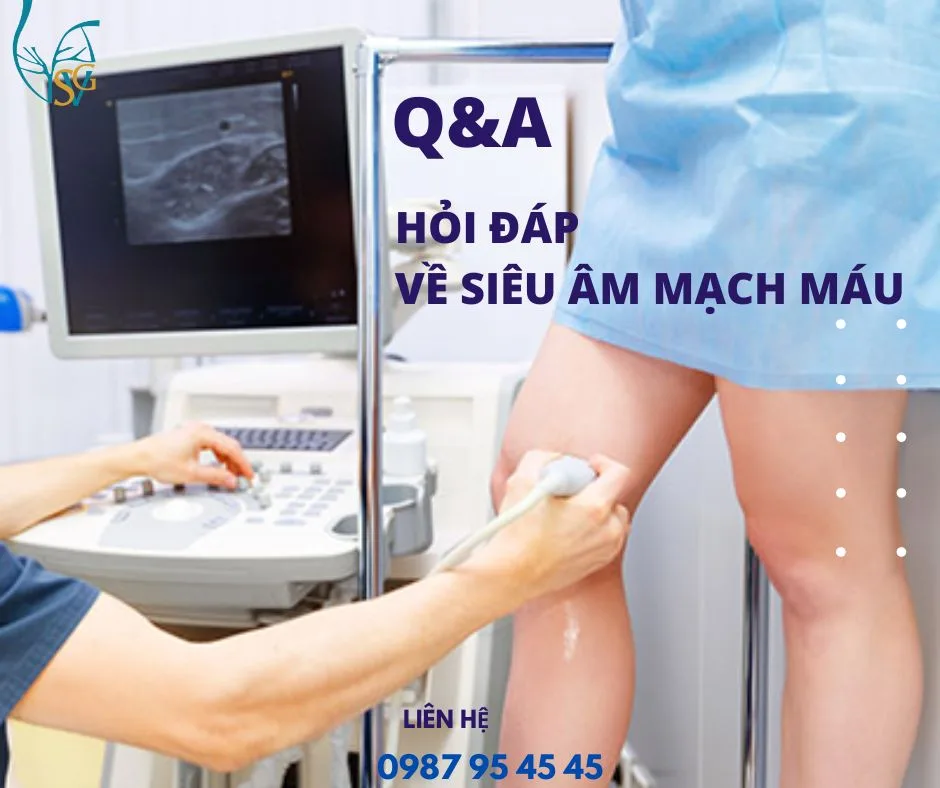 Hỏi đáp về siêu âm mạch máu