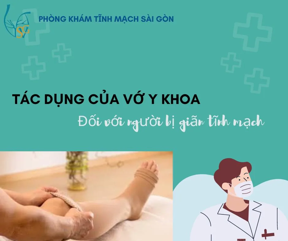 Tác dụng của vớ y khoa đối với người bị giãn tĩnh mạch