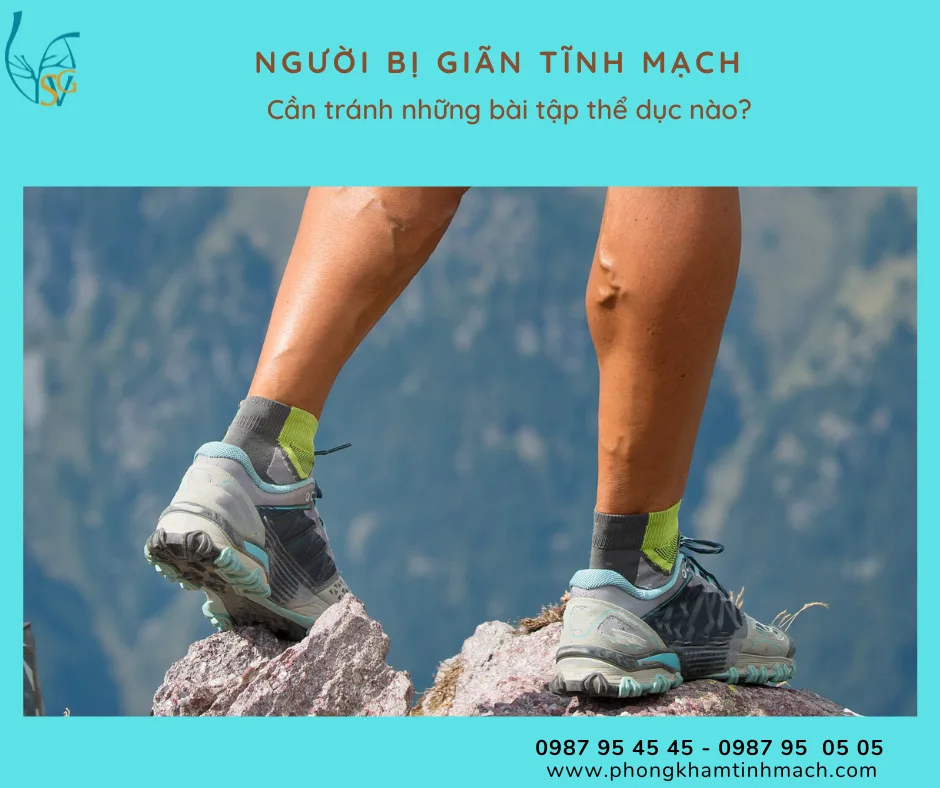 Những lưu ý khi tập thể dục đối với người bị giãn tĩnh mạch
